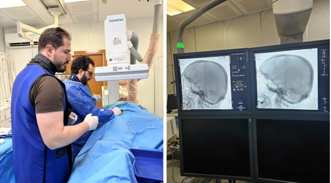 Ağrı'da Tıp Tarihi Yazıldı: İlk Beyin Anjiyografisi Başarıyla Gerçekleştirildi